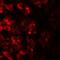 Transmembrane protein 106B antibody, NBP2-82027, Novus Biologicals, Immunofluorescence image 