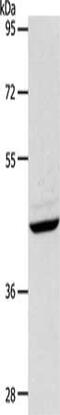 Plasminogen Activator, Tissue Type antibody, CSB-PA255864, Cusabio, Western Blot image 