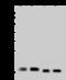 Ribosomal Protein S14 antibody, GTX02359, GeneTex, Western Blot image 