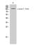 EPH Receptor A2 antibody, A00578Y594, Boster Biological Technology, Western Blot image 