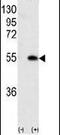 Calcium/Calmodulin Dependent Protein Kinase IG antibody, PA5-14096, Invitrogen Antibodies, Western Blot image 