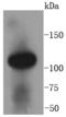 Angiotensin I Converting Enzyme 2 antibody, A00756-2, Boster Biological Technology, Western Blot image 