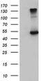 EGF Containing Fibulin Extracellular Matrix Protein 1 antibody, MA5-25740, Invitrogen Antibodies, Western Blot image 