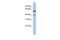 Cytochrome P450 Family 4 Subfamily V Member 2 antibody, GTX45139, GeneTex, Western Blot image 