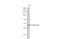 Beta-Transducin Repeat Containing E3 Ubiquitin Protein Ligase antibody, GTX102667, GeneTex, Western Blot image 