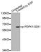 3-Phosphoinositide Dependent Protein Kinase 1 antibody, MBS128565, MyBioSource, Western Blot image 