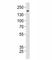 TSC Complex Subunit 2 antibody, F47746-0.4ML, NSJ Bioreagents, Immunohistochemistry paraffin image 