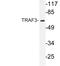 TNF Receptor Associated Factor 3 antibody, LS-C200029, Lifespan Biosciences, Western Blot image 