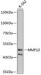 Matrix Metallopeptidase 13 antibody, 18-644, ProSci, Western Blot image 