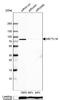 Methyltransferase Like 16 antibody, NBP1-81239, Novus Biologicals, Western Blot image 