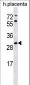 StAR Related Lipid Transfer Domain Containing 4 antibody, LS-C161545, Lifespan Biosciences, Western Blot image 