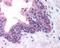 Fanconi anemia group D2 protein antibody, NB100-182, Novus Biologicals, Immunohistochemistry frozen image 