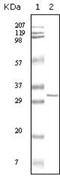 Hypoxanthine Phosphoribosyltransferase 1 antibody, NBP1-47358, Novus Biologicals, Western Blot image 