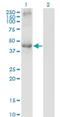 Transcobalamin 2 antibody, H00006948-M01, Novus Biologicals, Western Blot image 