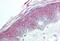 Histone Deacetylase 4 antibody, MBS241810, MyBioSource, Immunohistochemistry paraffin image 