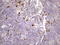 Nuclear Receptor Subfamily 2 Group C Member 2 antibody, LS-C791154, Lifespan Biosciences, Immunohistochemistry paraffin image 