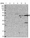 Transmembrane Protein 39B antibody, PA5-59110, Invitrogen Antibodies, Western Blot image 