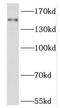 RPGRIP1 Like antibody, FNab07404, FineTest, Western Blot image 