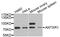 ANTXR Cell Adhesion Molecule 2 antibody, A03325, Boster Biological Technology, Western Blot image 