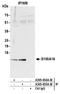 S100 Calcium Binding Protein A16 antibody, A305-654A-M, Bethyl Labs, Immunoprecipitation image 