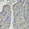 Carbonic Anhydrase 9 antibody, LS-C748717, Lifespan Biosciences, Immunohistochemistry frozen image 