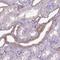 Cadherin 1 antibody, NBP1-84588, Novus Biologicals, Immunohistochemistry frozen image 