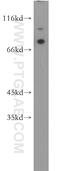MAGE Family Member D1 antibody, 11539-1-AP, Proteintech Group, Western Blot image 