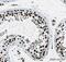 Histone Cluster 1 H1 Family Member C antibody, ab17677, Abcam, Immunohistochemistry paraffin image 
