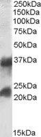 Clathrin light chain A antibody, TA305635, Origene, Western Blot image 