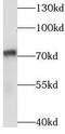 Spindle assembly abnormal protein 6 homolog antibody, FNab07613, FineTest, Western Blot image 