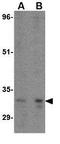 Autophagy Related 5 antibody, GTX31770, GeneTex, Western Blot image 