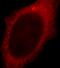 Thioredoxin Domain Containing 17 antibody, FNab09124, FineTest, Immunofluorescence image 