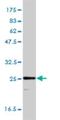 Triosephosphate Isomerase 1 antibody, H00007167-M01, Novus Biologicals, Western Blot image 