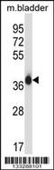 Eukaryotic Translation Initiation Factor 2 Subunit Alpha antibody, MBS9210061, MyBioSource, Western Blot image 