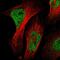 Nucleus Accumbens Associated 1 antibody, HPA021238, Atlas Antibodies, Immunofluorescence image 