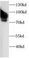 Endoglin antibody, FNab10759, FineTest, Western Blot image 