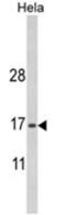 Mitochondrial Inner Membrane Protein MPV17 antibody, AP18119PU-N, Origene, Western Blot image 