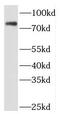 PAF1 Homolog, Paf1/RNA Polymerase II Complex Component antibody, FNab06106, FineTest, Western Blot image 