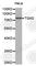 Transglutaminase 2 antibody, A0840, ABclonal Technology, Western Blot image 