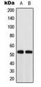 Acyl-CoA Thioesterase 2 antibody, GTX54912, GeneTex, Western Blot image 