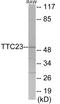 Tetratricopeptide Repeat Domain 23 antibody, EKC1853, Boster Biological Technology, Western Blot image 