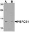 Chromosome 9 Open Reading Frame 116 antibody, TA320108, Origene, Western Blot image 