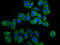 Adipocyte Plasma Membrane Associated Protein antibody, LS-C680169, Lifespan Biosciences, Immunofluorescence image 