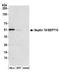 Septin 10 antibody, A304-915A, Bethyl Labs, Western Blot image 