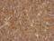 Actin Related Protein T1 antibody, GTX120431, GeneTex, Immunohistochemistry paraffin image 