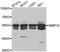Matrix Metallopeptidase 10 antibody, A3033, ABclonal Technology, Western Blot image 