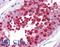 Chromosome Segregation 1 Like antibody, LS-B4307, Lifespan Biosciences, Immunohistochemistry paraffin image 