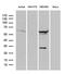 Protein Phosphatase 2 Scaffold Subunit Abeta antibody, LS-C795933, Lifespan Biosciences, Western Blot image 