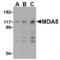 Interferon Induced With Helicase C Domain 1 antibody, ENZ-ABS299-0100, Enzo Life Sciences, Western Blot image 