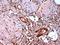 Estrogen Receptor 2 antibody, GTX41209, GeneTex, Immunohistochemistry paraffin image 